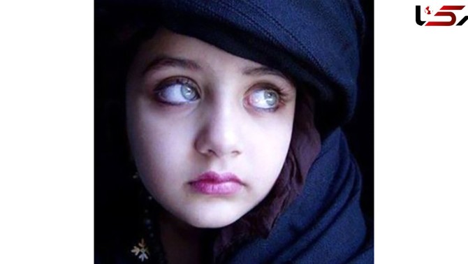 این دختر زیباترین چشم‌های جهان را دارد + عکس