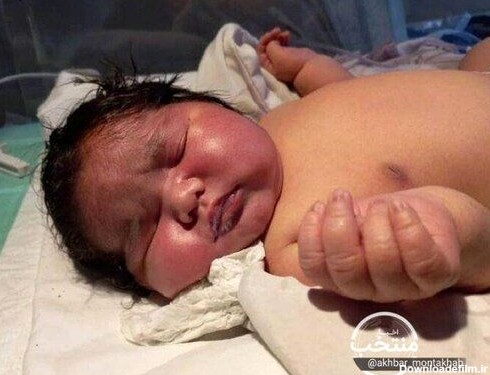 تولد نوزاد 6 و نیم کیلویی در مشهد+عکس