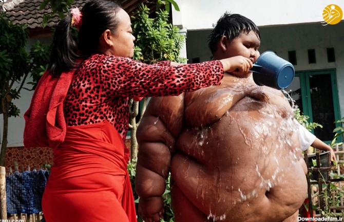 فرارو | (تصاویر) چاق‌ترین کودک جهان ۱۰۰ کیلو لاغر شد
