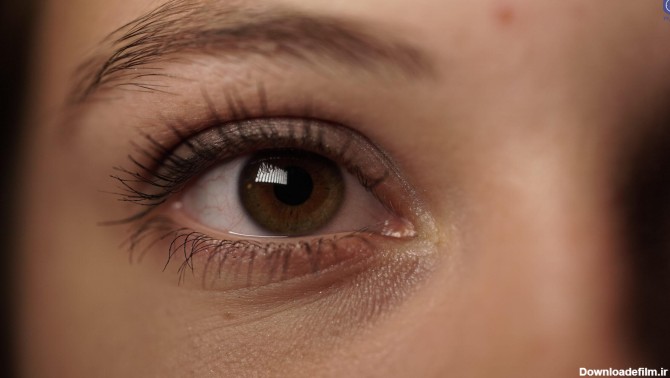 سیاهی زیر چشم در بارداری نشانه چیست؟ 6 درمان خانگی موثر | پذیرش۲۴