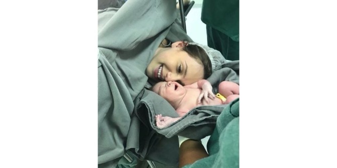 مدل عکس نوزاد در بیمارستان پس از جراحی در کنار مادر