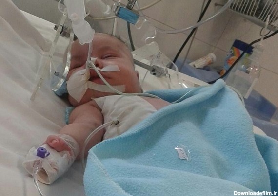 زندگی نباتی نوزاد 5 ماهه بر اثر قصور پزشکی +عکس - مشرق نیوز