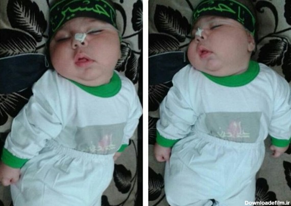 زندگی نباتی نوزاد 5 ماهه بر اثر قصور پزشکی +عکس - مشرق نیوز