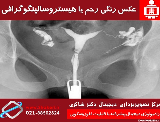 سونوگرافی رحم و تخمدان نی نی سایت | مرکز تصویربرداری دکتر شاکری