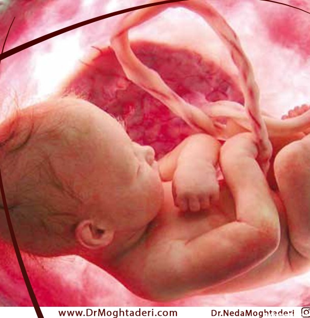 علت سقط جنین