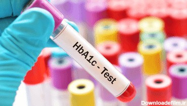 آزمایش هموگلوبین ای وان سی چیست و چگونه انجام می شود؟ | انجمن دیابت گابریک