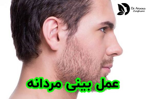 عکس عمل بینی مردانه طبیعی