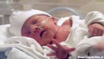 احتمال زنده ماندن نوزاد نارس چقدر است؟ || پزشکت
