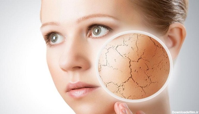 راه های تشخیص و درمان سریع خشکی پوست صورت و بدن
