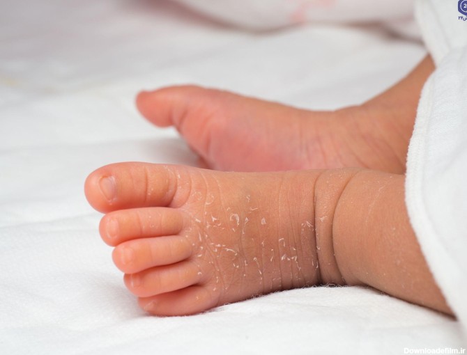 درمان خشکی پوست نوزاد با روش‌های ساده و موثر | پذیرش۲۴