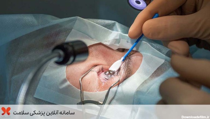 عمل لیزیک چشم / هزینه عمل لیزیک چشم سال ۱۴۰۱ | مجله سلامت حال