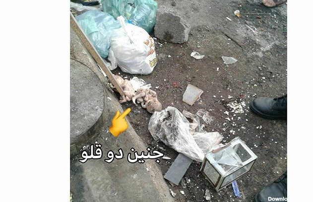انتشار عکس جنین ۲ قلو‌ها در زباله‌های رشت / خیلی تکاندهنده ...
