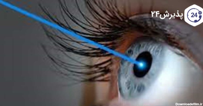 عمل لیزیک چشم برای چه کسانی مناسب است؟ | پذیرش۲۴