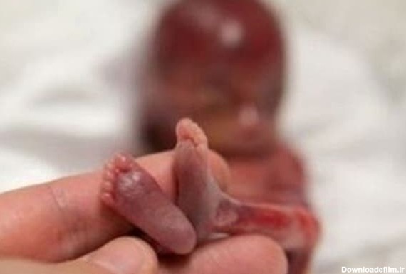 علائم سقط جنين چيست؟ | شیراز درمان | خدمات پزشکی و پرستاری ...