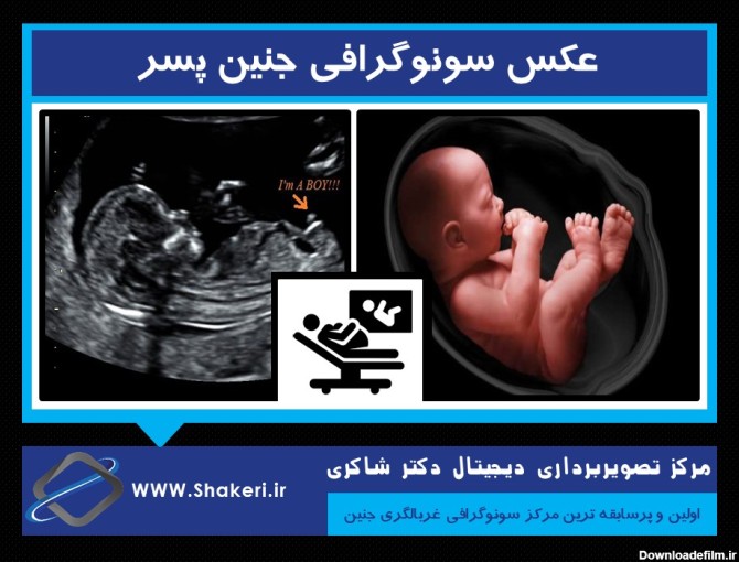 سونوگرافی رحم و تخمدان نی نی سایت | مرکز تصویربرداری دکتر شاکری