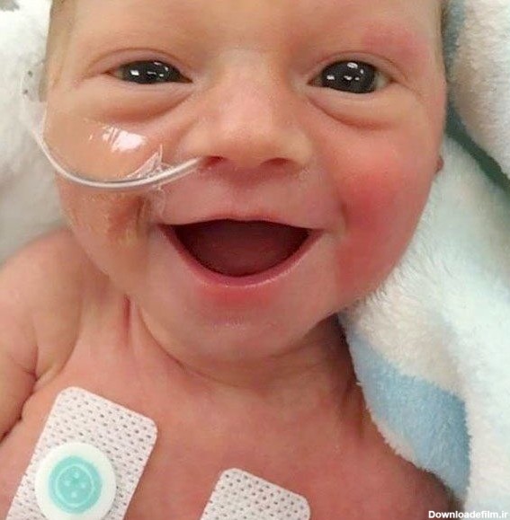 نوزاد نارس صاحب زیباترین لبخند دنیا