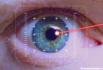 عمل فمتولیزیک چشم (Femto-Lasik) | چشم پزشکی نوآوران