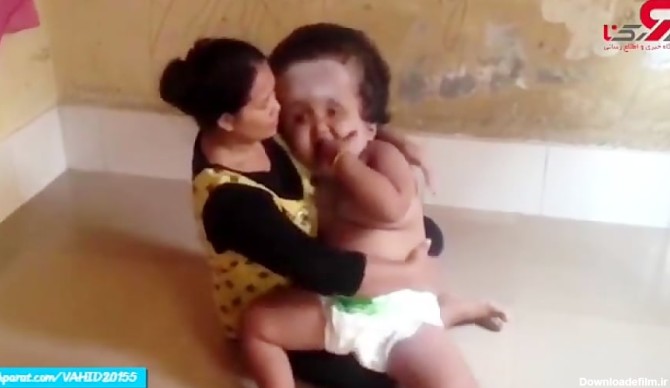نوزاد ترسناک عکس مغز انسان واقعی