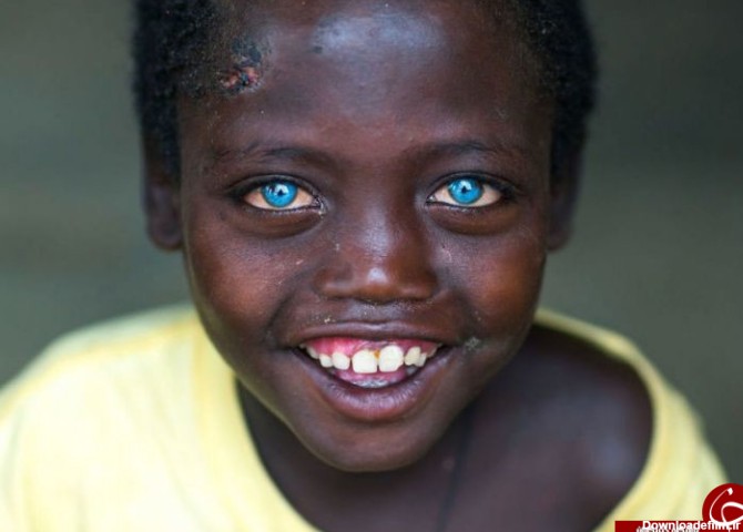 انتشار تصاویری از زیباترین کودکان چشم رنگی در فضای مجازی