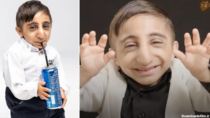 فرارو | (تصاویر) جوان ایرانی با کوچک‌ترین دست‌های دنیا رکورد زد