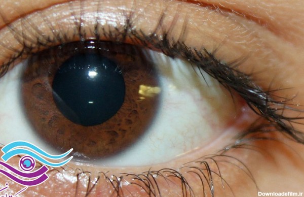 چرا قهوه‌ای رایج‌ترین رنگ چشم است