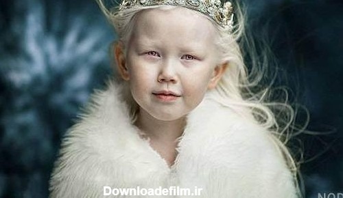 عکس سفید ترین دختر جهان - عکس نودی