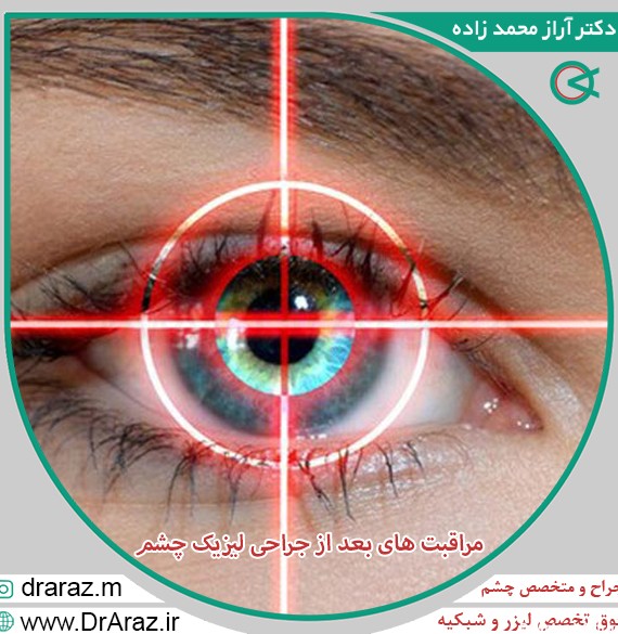 مراقبت های بعد از جراحی لیزیک چشم | لیزیک | دکتر محمدزاده