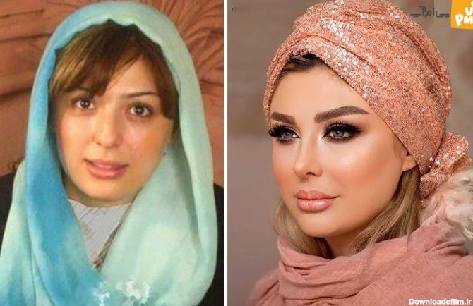 بازیگران ایرانی سردمداران عمل زیبایی در جهان / لو رفتن عکس های قبل ...