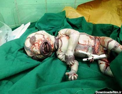 یک نوزاد ترسناک و عجیب الخلقه در شیراز به دنیا آمد!+عکس
