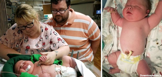 تولد نوزاد درشت با 6 کیلو و 700 گرم وزن!