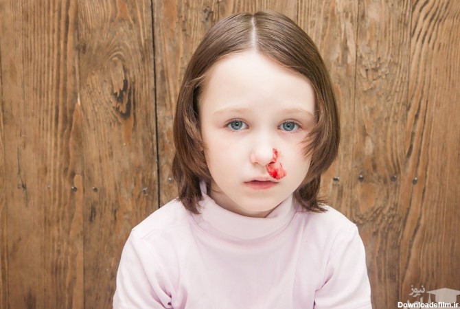 هنگام خونریزی بینی کودکان چه باید کرد؟