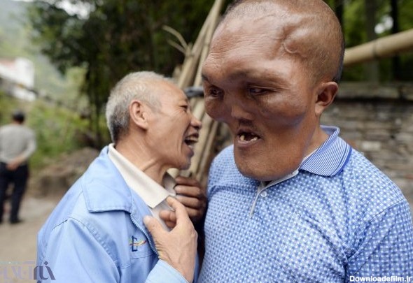 تصاویر | بیماری عجیب و غریب مرد چینی