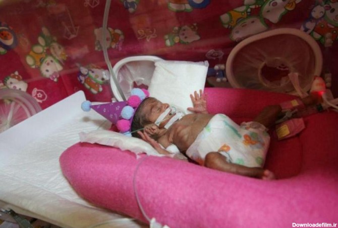تولد نوزاد ۶ ماهه در بیمارستان کنگان+عکس