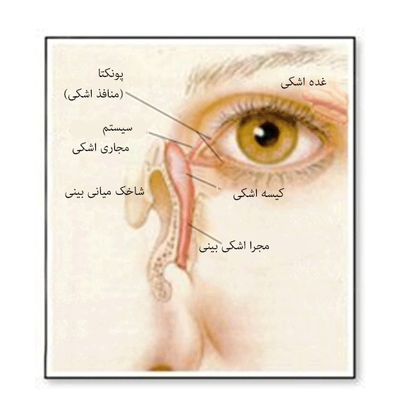 درمان اشک ریزش چشم با جراحی مجرای اشکی به روش آندوسکوپی - جراح ...