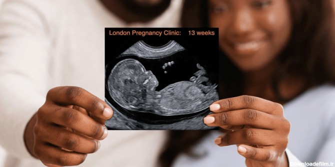 نحوه خواندن ریپورت وتفسیر تصاویر سونوگرافی بارداری