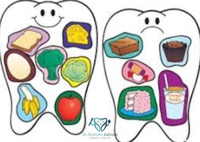ارتباط رژیم غذایی سالم و پوسیدگی دندان ها - دکتر شهره زهرایی