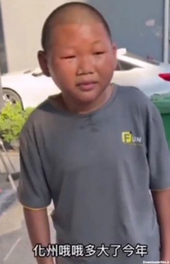 چهره عجیب مرد چینی | مرد 27ساله چینی با چهره عجیب که شبیه 12ساله هاست