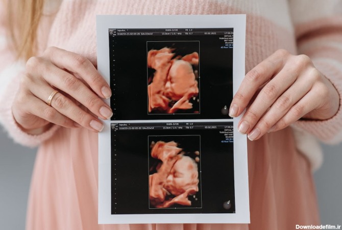 نکات مهم سونوگرافی جنین و حاملگی - مجتمع جامع پزشکی صدر