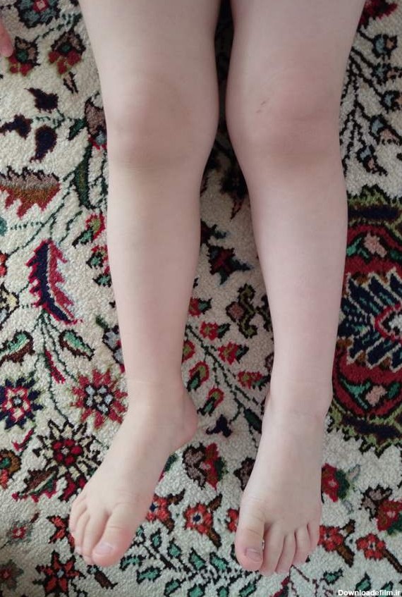پاهای بچه 2.5ساله | تبادل نظر نی نی سایت