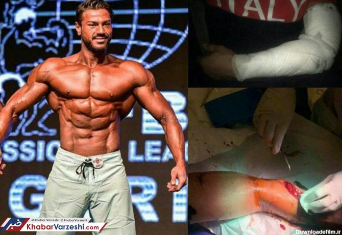 عکس| حمله وحشتناک با قمه و چاقو به قهرمان بدنساز ایرانی