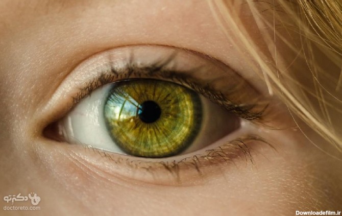 عمل تغییر رنگ چشم ، یک آرزوی محال یا واقعی؟ – مجله سلامت دکترتو