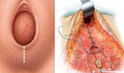 عکس جای زایمان طبیعی