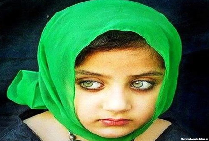 این دختر بچه زیباترین چشم‌های جهان را دارد + عکس