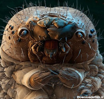 16 عکس ترسناک از زیر میکروسکوپ ( از جنین مرغ تا ...)
