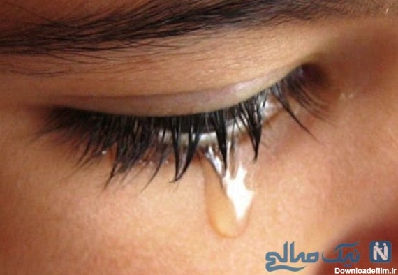 خون گریه | خون گریه کردن پسر 23 ساله عراقی به جای اشک چشم