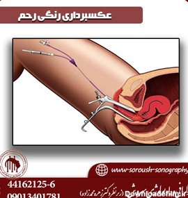 کجا برم عکس رنگی رحم بگیرم