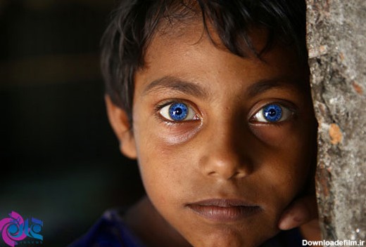 کودکی با چشمان حیرت آور (+عکس)