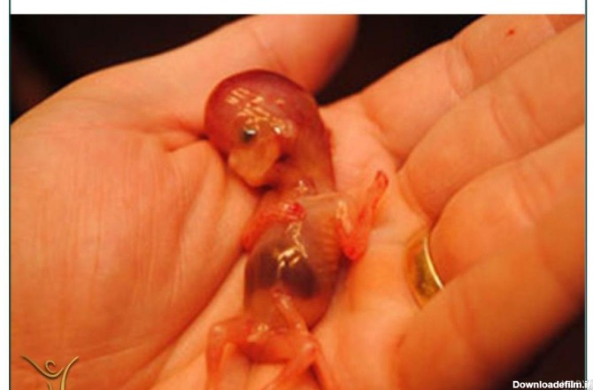 عکس جنین سقط شده پنج هفته ای پسر