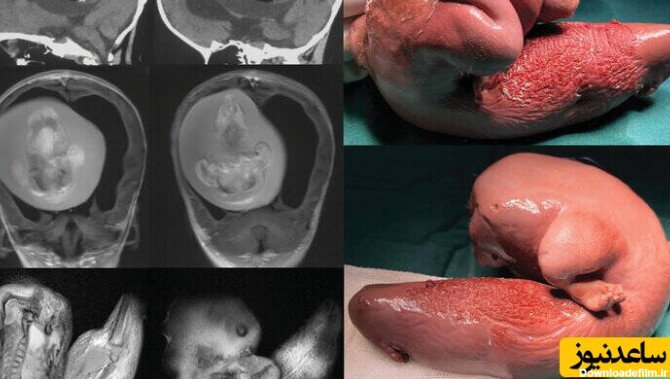 عکس جنین داخل شکم مادر