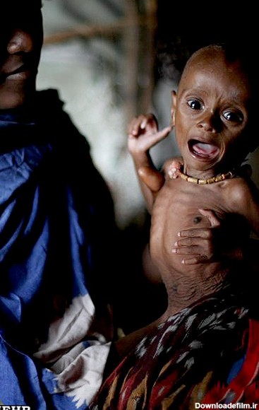 تصاویر دردناک کودکان گرسنه/ سومالی یکی از بدترین کشورها برای زنان ...
